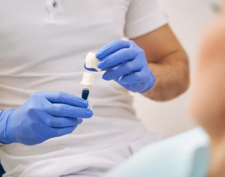 Praticien ganté manipulant une couronne destinée à un implant